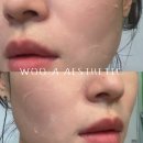 우아에스테틱 네이버블로그