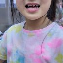 임플라인치과의원의정부점 | 첫째 교정 시작! 교정전문치과가 아닌 의정부 고산정담치과로 결정한 이유