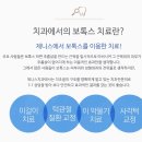 서울제니스치과의원 네이버블로그