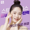 폴라인피부과의원 | 둔산동피부과 피부리프팅, 탄력관리 레드터치로