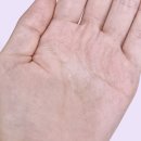 진진약국 | 피부 좋아지는법 여드름 케어후기