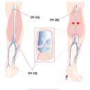 미래외과 네이버블로그