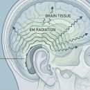이편한보청기 이미지