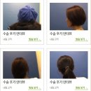 부부관계 개선? 질성형 잘하는곳이 해결책이 된다?