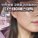 부평에스테틱 더스테이 에스테틱, 고주파 리프팅관리 후기