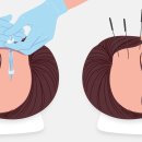 재생한의원 이미지