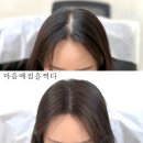 광주 마음에점을찍다 광주본점 SMP 두피 문신 두피케어 최고!!