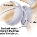 광주주사랑의원 이미지