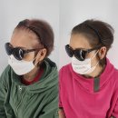 스칼프K 이미지