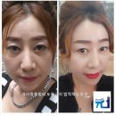 볼륨톡스 이미지
