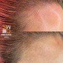 미우대구피우다뷰티 네이버블로그