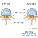 디스크잼