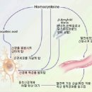 호모시스테인의 위험 이미지