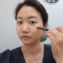 원주피부과 유명한곳 촉촉한 앨러간 스킨바이브+스킨보톡스 (원주최초도입)후기