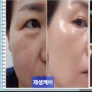 퇴계원역 | 내 인생의 피부관리샵 찾았다! 가꾸는동안 남양주 퇴계원역점 솔직 후기