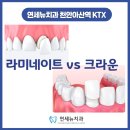 [천안아산역KTX연세뉴치과] 크라운 vs 라미네이트, 뭐가 다를까? 나한테 맞는 치아 치료는?