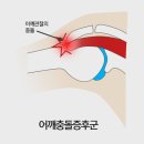 Y노래연습장 | 미사PT / 어깨통증 원인 / 어깨통증 해결방법 / 어깨통증 자가진단방법 / 미사헬스 / 메가나인피트니스...