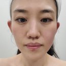 오롯이미 - 김포시 김포한강1로 238 | 동탄피부관리 [오롯이미 동탄점] :: 윤곽관리 1회차 후기