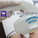 IPL, 레이저토닝 효과 이미지