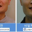 한울치과교정과치과의원 네이버블로그