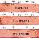 콜레스테롤 이미지