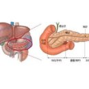 췌장암 초기 췌장암 등 통증 위치 부위 췌장암 대변 색 췌장암 이미지