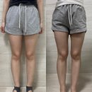 [청담 다이어트] 라인이펙터로 셀룰라이트 쏙 정리한 지방관리 /지방분해주사 전후 비교 후기