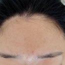 고덕 | [뷰티_평택] 평택고덕에스테틱 ‘레오네뷰티 평택고덕점’ 시술 후기