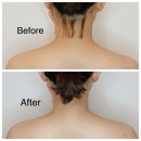 백운역 고객화장실 | 부평 에스테틱 비포에프터가 확실한 유리햅에스떼 윤곽관리 후기