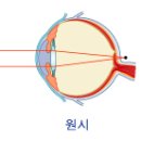 아이피아안경 이미지