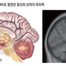 플라시보 이미지