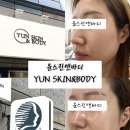 윤(Yoon)스킨앤바디 | 윤스킨앤바디 : 대구 스킨케어 문제성 피부 리셋관리 후기
