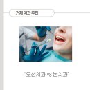 거제 치과 추천! 믿고 갈 수 있는 오션치과 &amp; 본치과 솔직 후기