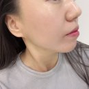 그린메디컬플라자 | 수원 금곡동 피부관리 늘그린스킨 끌올팅 리프팅 케어 후기