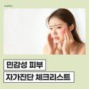 (주)유니베라 - 동구 | 민감성피부 자가진단 체크리스트 예민한 피부, 어떻게 관리해야 할까?