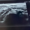 휴먼영상의학과의원 네이버블로그