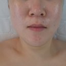 시흥 장곡동 스킨케어 루미유 토탈뷰티샵 찐만족 후기