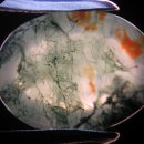 보석감정사(기능사) 시험스톤 - 58. 모스 아게이트(Moss Agate) 이미지