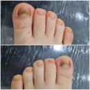 레푸스 앤 두두네일 이미지