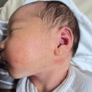 문산부인과 | 송파 포유문산부인과 제왕절개 후기 (2) (실망스러운 신생아실 _RSV접종누락)