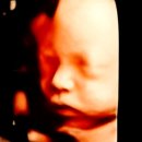 하의중학교 | [임신 후기 28주-36주] 산후도우미 예약, 임신 후기 단축근무, 산전 육아휴직, 막달 검사, 태동 검사...