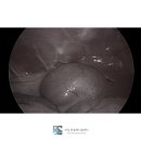 논산동물병원 | 논산 강아지 CT 동물병원 PSS 간문맥단락증 수술 후기
