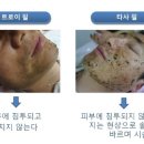 트로이샵