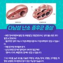 소문난소