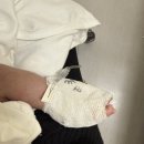 경대아이키움소아청소년과의원 | [유문협착증 증상] 1개월 신생아 분수토, 분수토 원인으로 유문협착증 의심/분유량