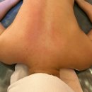 살롱드희(Salon de H) | [아산 피부관리] 탕정 피부샵 "살롱드희" 등관리 후기