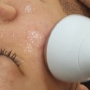 김포피부관리 기미효과본 비비드엘 인천점 후기
