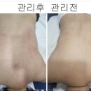 수피부샵 - 아산시 | 수피부샵