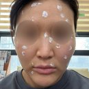 메디칼중앙약국 | 오산 중앙메디칼의원 &lt;출산 후 얼굴 점 빼기!가성비 쩌는 곳 ㅇㅈ&gt; 평일 방문 후기, 가격정보 등^^