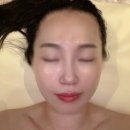 더피움 | 첨단피부관리 더피움에스테틱 다이아몬드무결점관리 후기